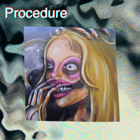 Procedure