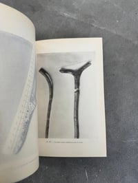 Image 7 of La Photographie au Laboratoire de Médecine Légale - Dr. Alphonse Bedin
