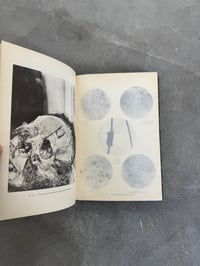 Image 16 of La Photographie au Laboratoire de Médecine Légale - Dr. Alphonse Bedin