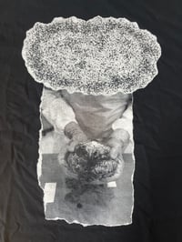 HYDROENCEPHALOCYSTOCELE t-shirt