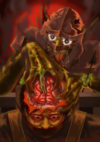 Brain Surgery