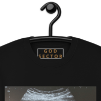 Image 4 of Custom Ultrasound Merch | Popular & In-Demand | Submit your Ultrasound pic!