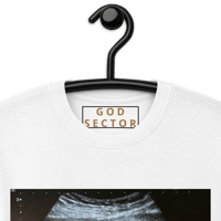 Image 6 of Custom Ultrasound Merch | Popular & In-Demand | Submit your Ultrasound pic!