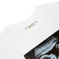 Image 8 of Custom Ultrasound Merch | Popular & In-Demand | Submit your Ultrasound pic!