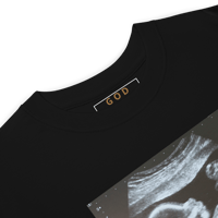 Image 7 of Custom Ultrasound Merch | Popular & In-Demand | Submit your Ultrasound pic!