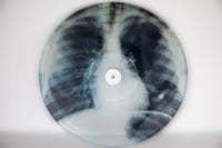 Image 2 of "THE END" Bonus Songs From Egg & Dart