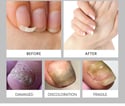  healthy nail / uñas largas