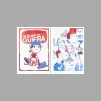 Image 4 of [PILA™] MIOPÍA