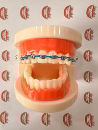 Clip On (Power Chain) FashionBraces Mod - Non-Orthodontic Cosmetic Accessory 
