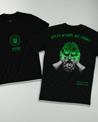 Image 2 of WOUNDS BUNDLE