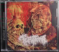Image 1 of Teratoma - Purulent Manifestations - CD