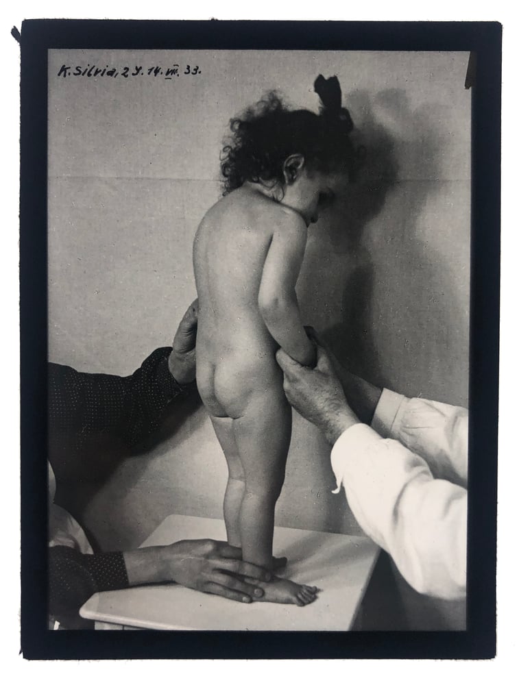 Image of Unknown: medical photo of K. Silvia, ca. 1933