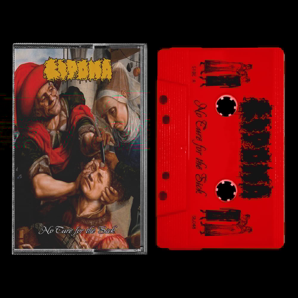 LIPOMA - "No Cure For The Sick" cassette