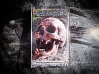 Image 2 of Estenosis "Desentarramiento Sepulcral" MC