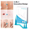 Micro Skin Tag Remover Device Kit Safe Painless Removal 1-8 mm Band Tool