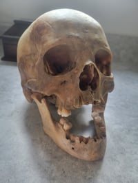 Image 1 of Véritable crâne humain avec mâchoire
