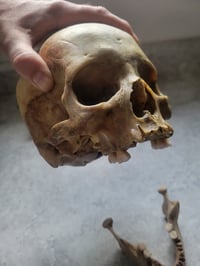 Image 4 of Véritable crâne humain avec mâchoire