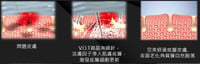 Image 5 of VOT 微晶海綿針👸🏻真人實測