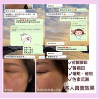 Image 5 of 皇牌Zo SKIN Health 皮秒袪斑霜✨針對荷爾蒙斑/黃褐斑/色素沉澱