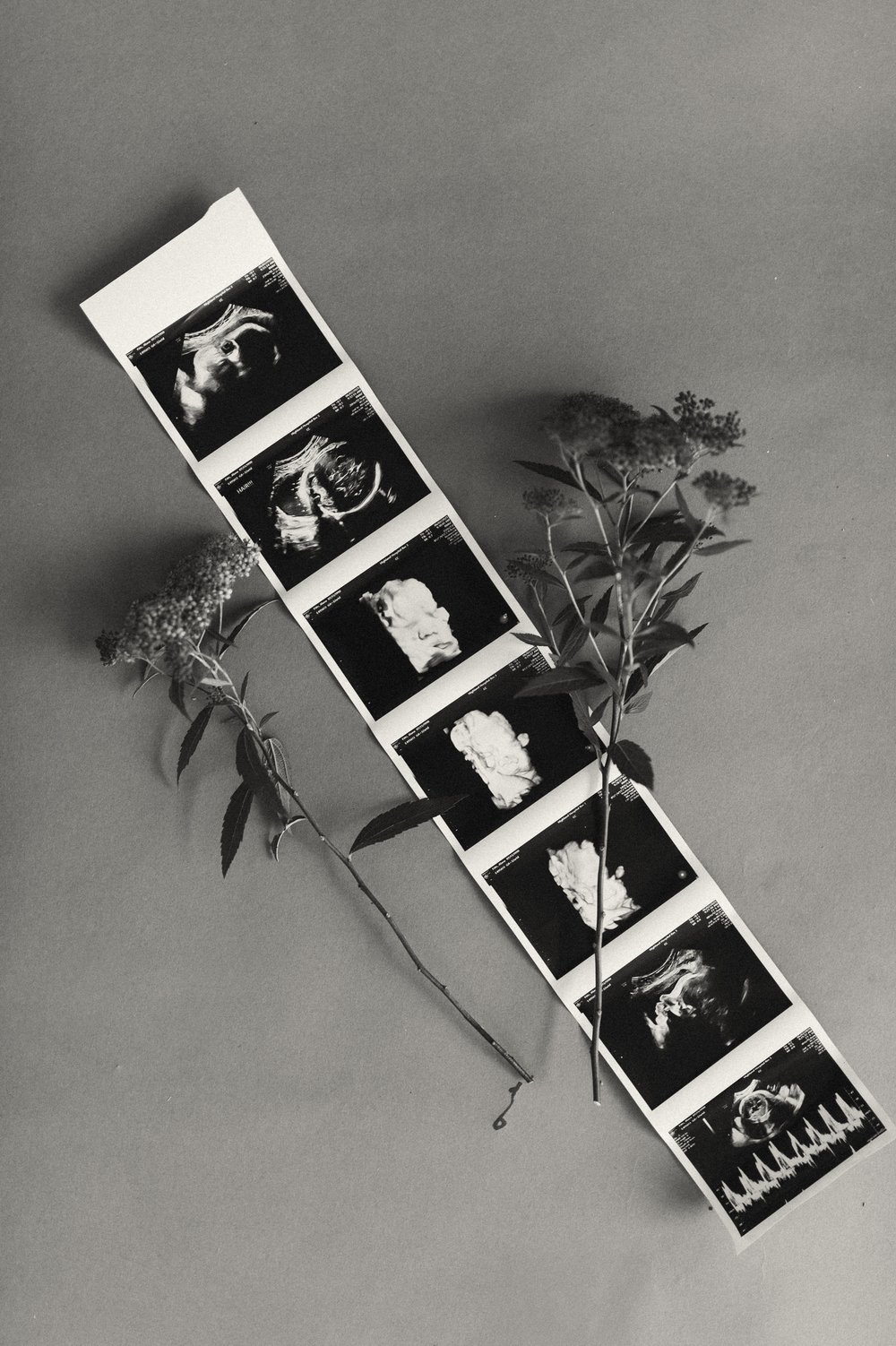 Image of Birth Photography + Doula Services