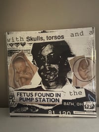 Image 2 of Female Autoerotic Asphyxiation - A Loner's Morbid Fascination... CS