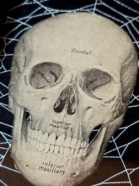 Image 3 of ANTIQUE ANATOMICAL COLLECTION - Preserved web  F