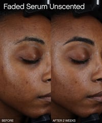 Image 4 of TOPICALS - 15 ml Sérum Faded Éclaircissant Pour les Taches Brunes et L'hyperpigmentation