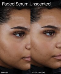 Image 3 of TOPICALS - 15 ml Sérum Faded Éclaircissant Pour les Taches Brunes et L'hyperpigmentation