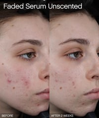 Image 4 of TOPICALS -  30 ml Sérum Faded Éclaircissant Pour les Taches Brunes et L’hyperpigmentation