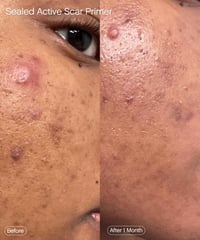 Image 2 of TOPICALS - Apprêt De Remplissage De Cicatrice Scellé