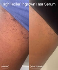 Image 2 of TOPICALS - Tonique Pour Poils Incarnés High Roller