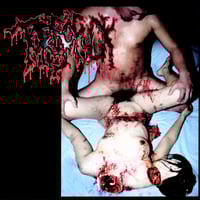 Image 1 of Torsofuck/lymphatic phlegm-Disgusting Gore And Pathology / Polymorphisms To Severe Sepsis In Trauma