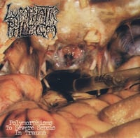 Image 2 of Torsofuck/lymphatic phlegm-Disgusting Gore And Pathology / Polymorphisms To Severe Sepsis In Trauma