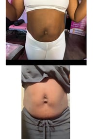 Image 5 of At Home Lipo Shot Fat Dissolver