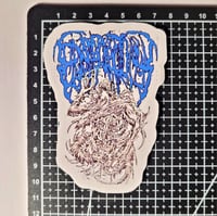 Image 2 of Epicardiectomy Blue Band Logo Glossy Finish LAMINATED Vinyl Sticker
