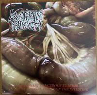 Image 1 of Flesh Grinder / Lymphatic Phlegm - From Rotten Process... to Splatter /Malignant Cancerous Tumour LP
