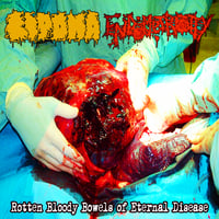 Lipoma / Endometriosity - Rotten Bloody Bowels of Eternal Disease