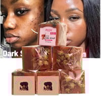 Image 1 of 🌸 Savon Anti-Taches & Anti-Acné à la Rose 🌸