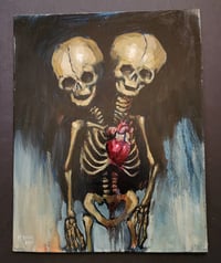 Image 1 of "Conjoined Fetal Twin Skeleton" - Oil Painting