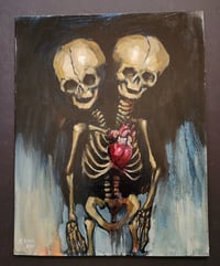 Image 2 of "Conjoined Fetal Twin Skeleton" - Oil Painting