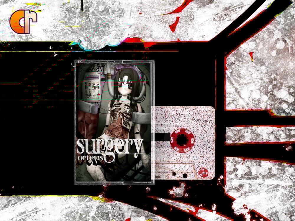 Image of orteus - surgery