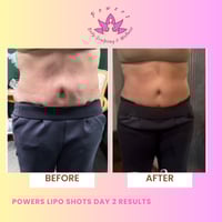 Powers Lipo Shots (3 Bottles) Normal 1st Order