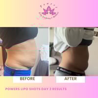 Powers Lipo Shots (2 Bottles) Good For Reorders