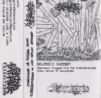Sulfuric Cautery ''Chainsaws Clogged with..." - Cassette