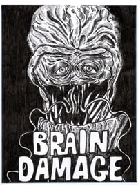 Brain Damage Original Artwork