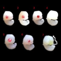 Image 3 of Angel Fetus (LITTER 1)