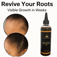 Image 1 of Luxxgro Rosemary & Clove Strengthening Hair Oil – 16oz