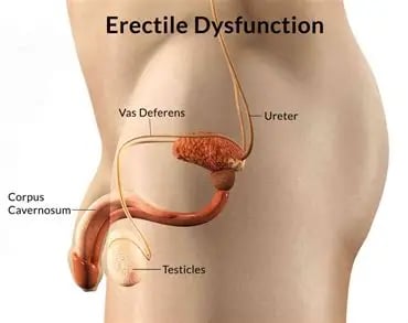 Get SEXy! (Low T/Low E Blend Viagra Blend)-Sex Drive-Circulation-Cholesterol-Energy-ED-Estrogen