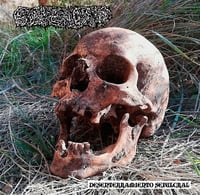 ESTENOSIS - Desenterramiento Sepulcral CD