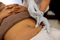 Powers Lipo Shots (5 Bottles) Max Order